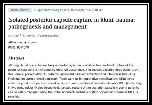 Posterior capsular rupture in blunt trauma