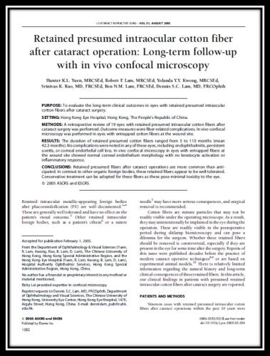 Retained presumed intraocular cotton fiber after cataract operation
