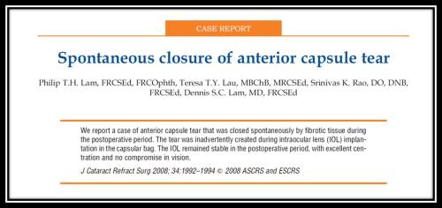 Spontaneous closure of anterior capsular tear