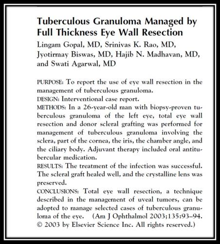 Tuberculous granuloma managed by full thickness eye wall resection
