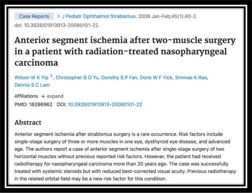 Anterior segment ischemia after two muscle surgery in a patient with radiation treated nasopharyngeal carcinoma